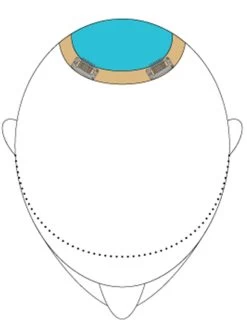 Top This 8" By Jon Renau | Remy Human Hair | Renau Exclusive 21 Top This 8" By Jon Renau | Remy Human Hair | Renau Exclusive -Do it with Wig shop. TopThis placement 65e9f77c 8719 46d0 9bf0 62c94448aa04